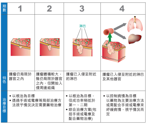 stage table