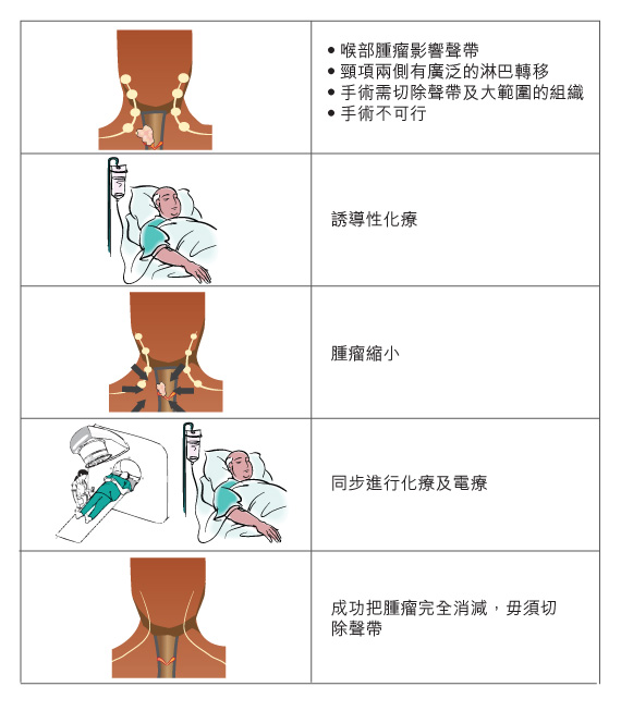 neoadjuvant therapy