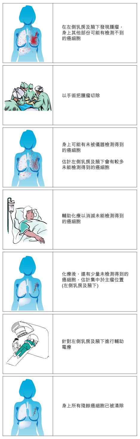 adjuvant therapy