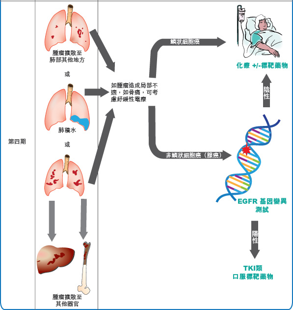 lung cancer treatment 2