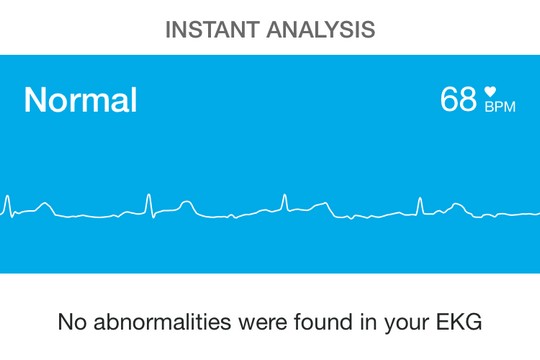 mobile ECG, 手提心電圖, 心率, 心電圖