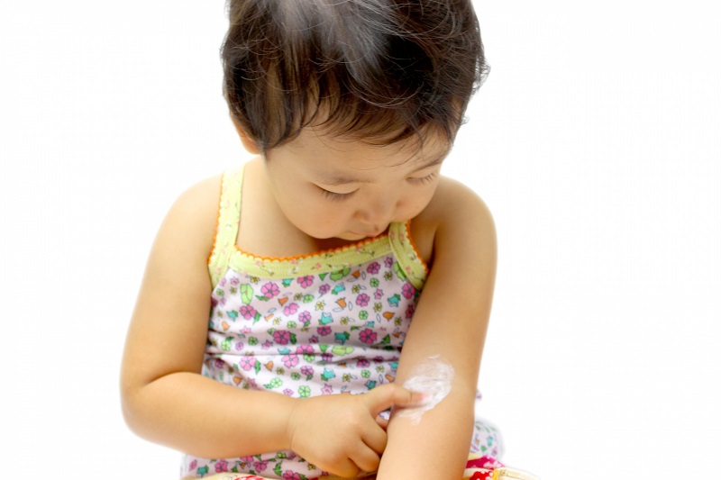 濕疹可根治?推介5款防敏配方潤膚霜及非類固醇濕疹藥膏