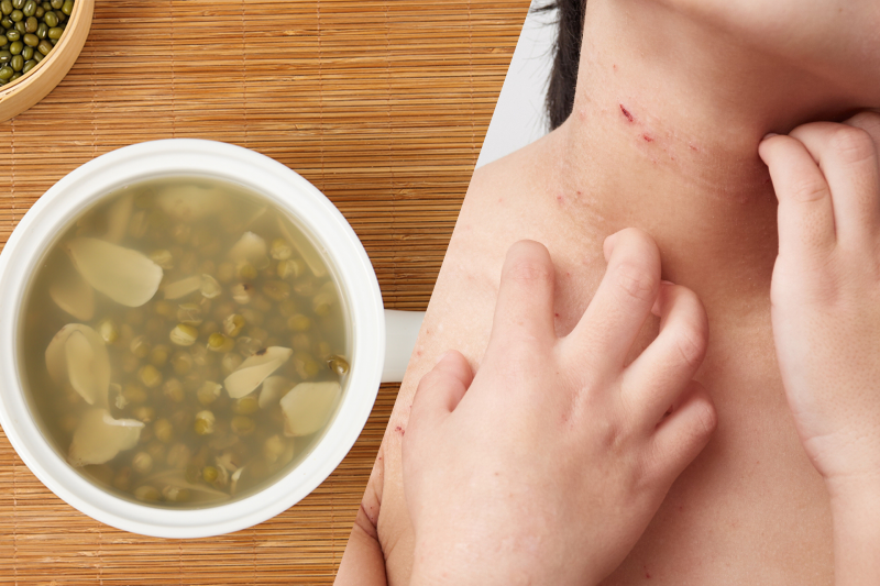 轉季皮膚痕癢?10個紓緩濕疹湯水食療合集