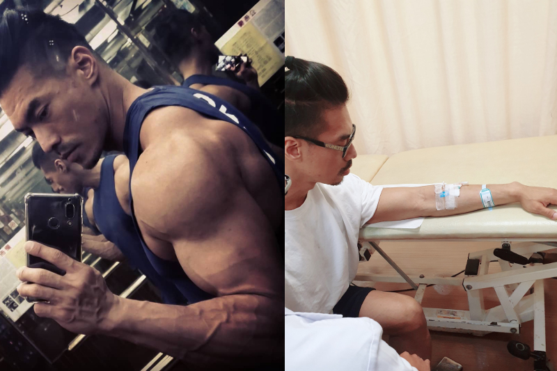 台湾37岁肌肉爸爸突中风 三高符合标准罹病原因竟是