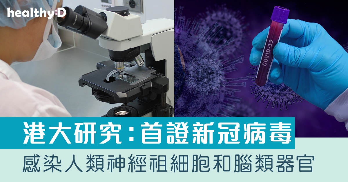 【新冠肺炎】港大中科院首發現可感染人腦神經