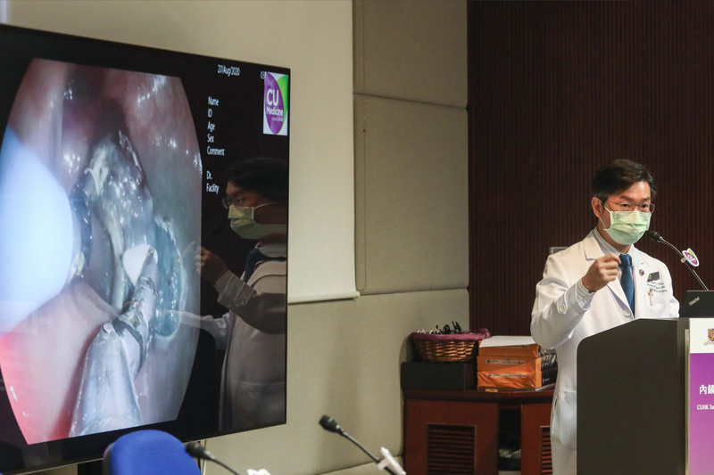 【大腸癌治療】全球首例!中大無創內鏡手術機械人治大腸癌