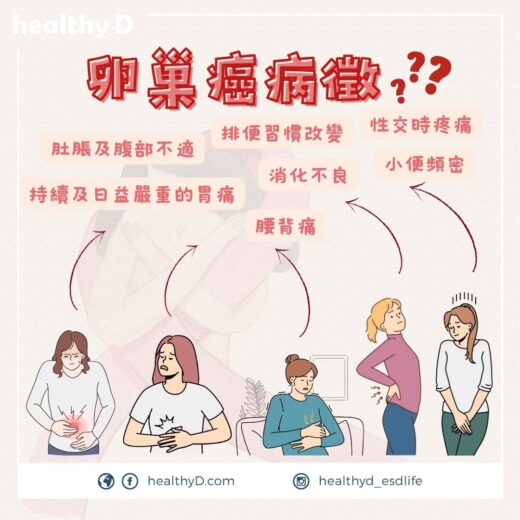 卵巢癌病徵