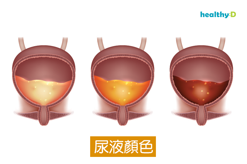 小百科：從尿液看健康