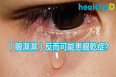 「眼濕濕」反而可能患眼乾症？