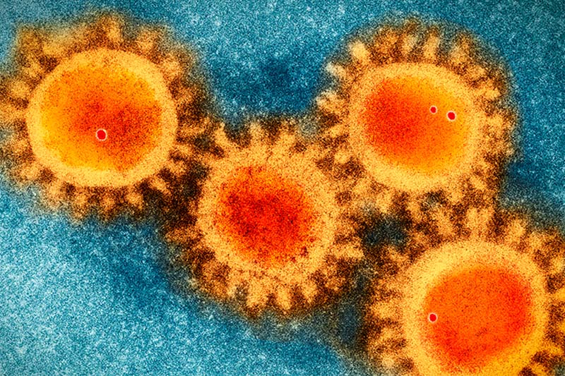 新型冠狀病毒是人造病毒？ 美國研究否定人造說法