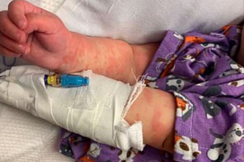 美國6個月大女嬰3月同患川崎症與新冠肺炎 被懷疑是合併感染首例