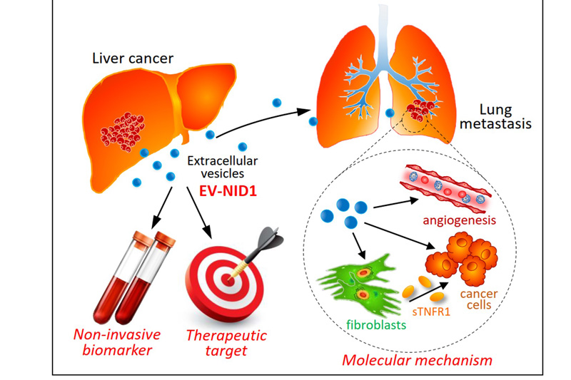 【肝癌治療】港大研究揭抑制胞外囊泡生長 可減低腫瘤生長及轉移