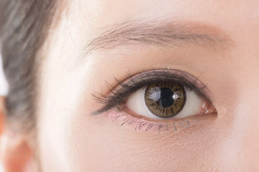 整形外科醫生分享 6種割雙眼皮手術的效果