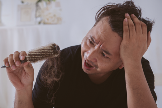 脫髮原因 | 中醫解構男士掉髮危機及治療方法