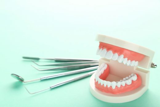 箍牙時間｜箍牙有年齡限制？了解箍牙過程及注意事項