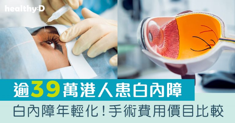 白內障手術2026｜常見5大人工晶體種類、功效及好處一文睇清｜附12間香港私家醫院醫療收費比較