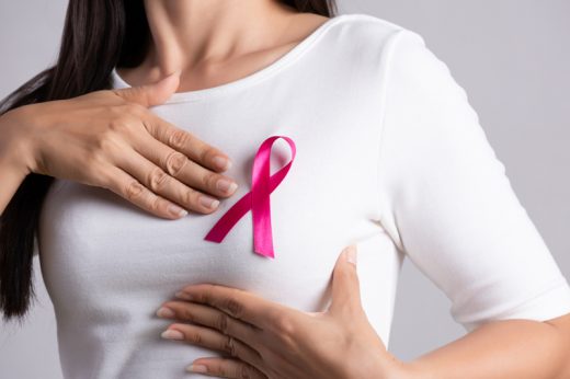 乳癌分期｜4分1乳癌病人帶PIK3CA基因變異 增轉移性腦腫瘤風險(附預防乳癌飲食貼士)