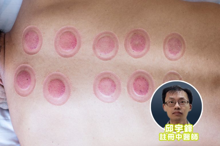 拔罐功效多