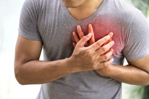 胸口痛等如心臟病？其實可能係胃酸倒流！