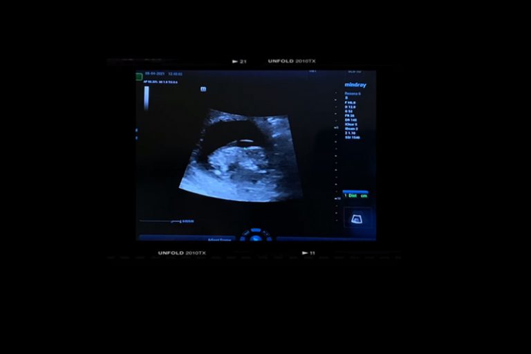 Leanne：這一次會是我最後一次懷孕