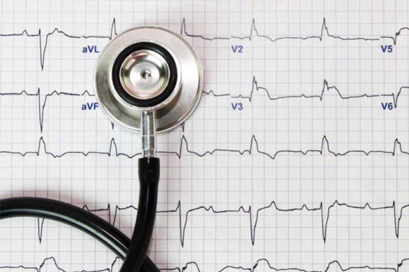 心臟檢測要check什麼？簡介6個心臟檢查項目 + 7大心臟檢查計劃比較 2