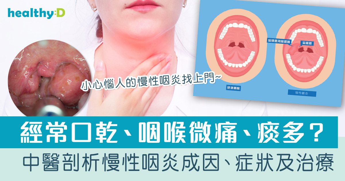 慢性咽炎 | 中醫剖析慢性咽炎成因、症狀、診治及治療 - 註冊中醫師邱宇鋒 | healthyD.com