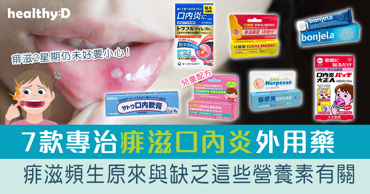 痱滋膏藥 | 急救止痛!推介7款專治飛滋/口內炎/口腔潰瘍外用藥膏藥貼功效比較 (持續更新) | healthyD.com