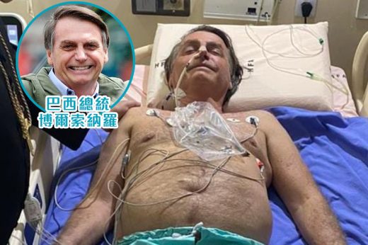 打嗝原因｜巴西總統連續10日打嗝 有傳接受腸阻塞檢查 或需要緊急手術