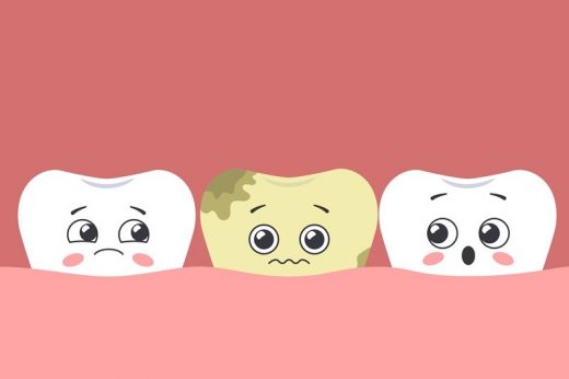 兒童牙齒健康 | 孩子有蛀牙怎麼辦？針對牙患嚴重程度提供治療方案