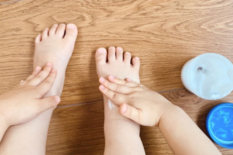 濕疹藥膏塗搽位置要知道