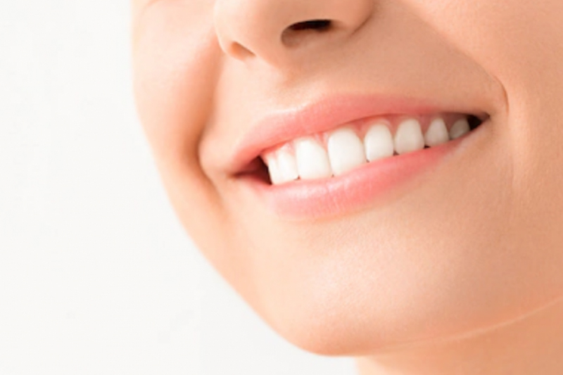 4個天然方法美白牙齒 用梳打粉刷牙可以去污漬？
