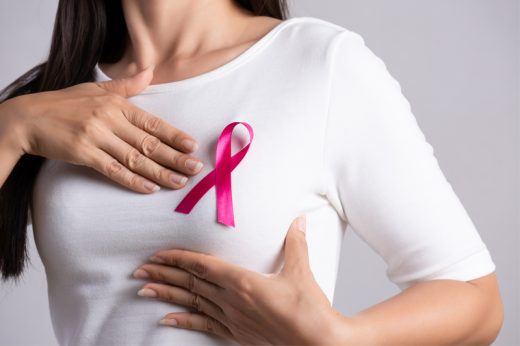 國際乳癌關注月 | 乳癌初期存活率可達八成！醫生詳解乳癌分期的病患特徵及治療方案