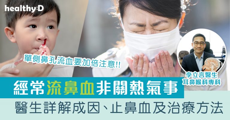 突然單側流鼻血要小心！醫生詳解流鼻血原因、止鼻血處理、治療及預防方法 | 常流鼻血原因非關熱氣事