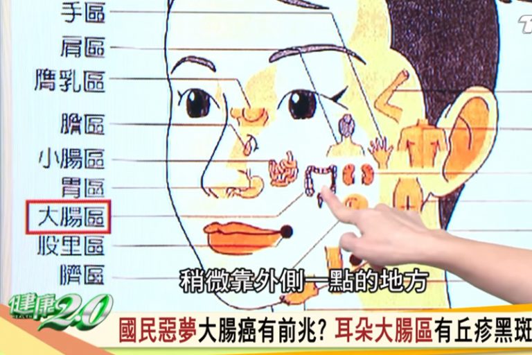 中醫可根據耳朵及面部的「反射區域」表現來揪出大腸癌