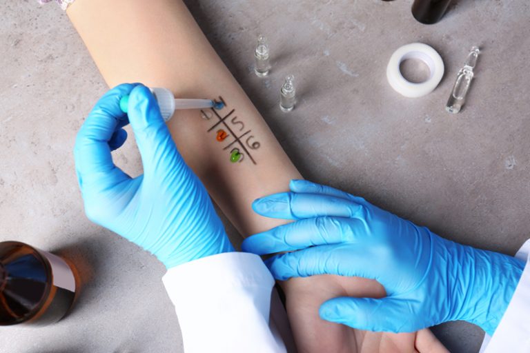 過敏藥-推薦-比較-皮膚敏感-鼻敏感-食物敏感-原因-症狀-口服抗過敏藥-急救過敏症-幸福過敏素-Clarityne佳力天-Zyrtec治敏速-退敏快D-Telfast-敏感測試