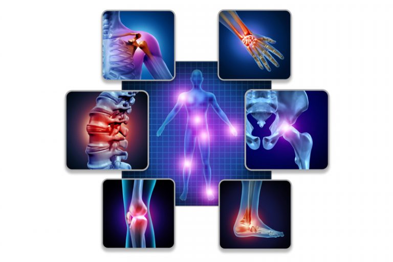 關節保健品推薦