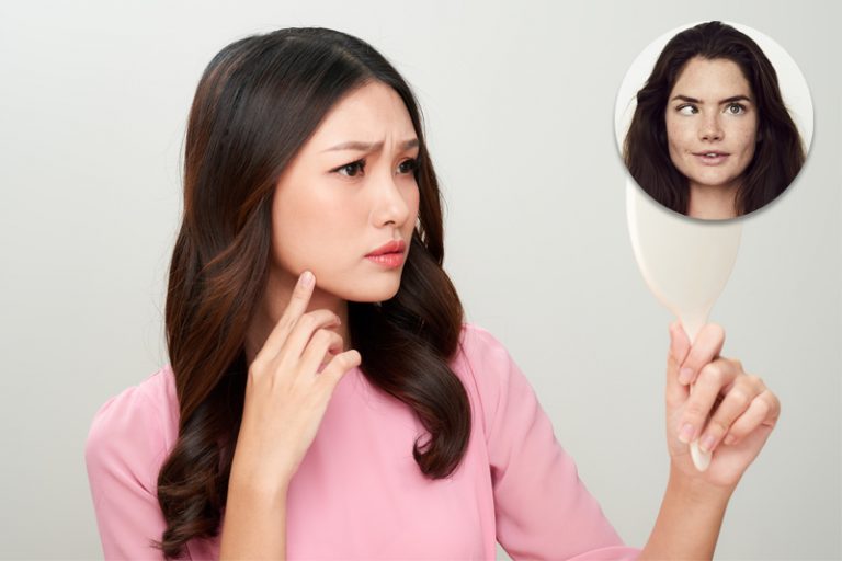 糖尿病併發症-單邊鬥雞眼