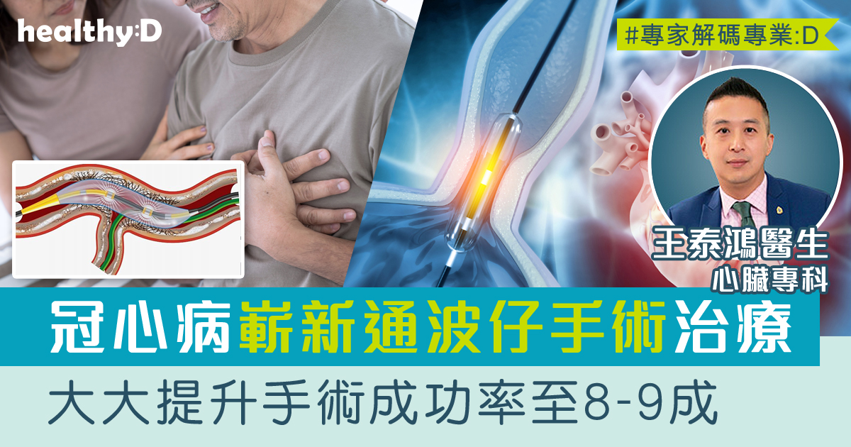 冠心病嶄新療法 | 心臟專科王泰鴻醫生:血管衝擊波球囊技術(IVL)提升通波仔手術成功率及安全度 - 心臟科專科醫生王泰鴻 ...