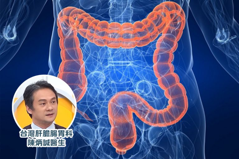 大腸瘜肉|24歲男為省錢3年來每餐吃即食麵 因便秘照腸鏡發現長3cm瘜肉 險變大腸癌
