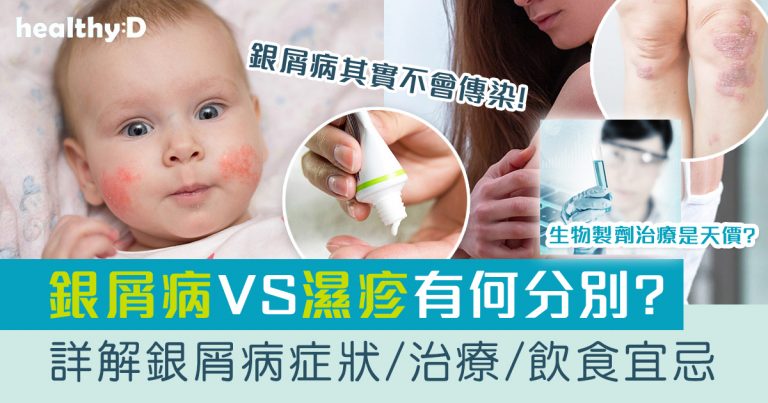銀屑病/牛皮癬 | 與濕疹有何分別？詳解銀屑病飲食戒口宜忌、前兆症狀、成因、治療、傳染性及護理