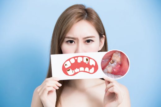 智慧齒不夠位生長怎麼辦？3大影響你要知：蛀牙/牙周病、冠周炎、牙齒囊腫