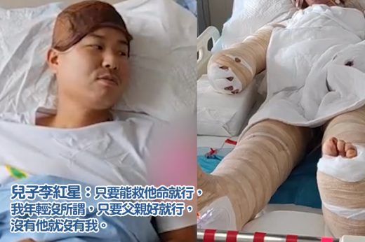 66歲父遇煤氣罐爆炸致全身七成燒傷 孝子瞞父捐皮膚（附嚴重燒傷/燙傷處理方法）