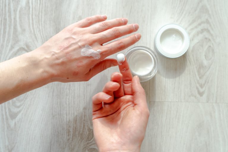 濕疹新型治療-口服JAK抑制劑-生物製劑-功效-副作用-日常護理