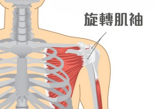 肩膊痛不一定是五十肩(肩周炎)  可能是旋轉肌袖撕裂