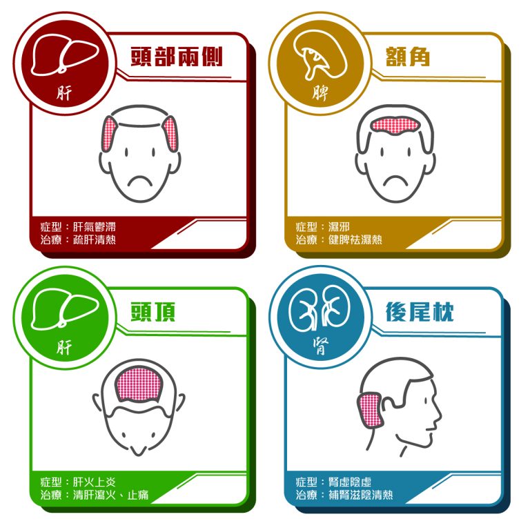 生頭瘡-油膩麻辣食物-中醫拆解頭皮生瘡常見原因-治療方法