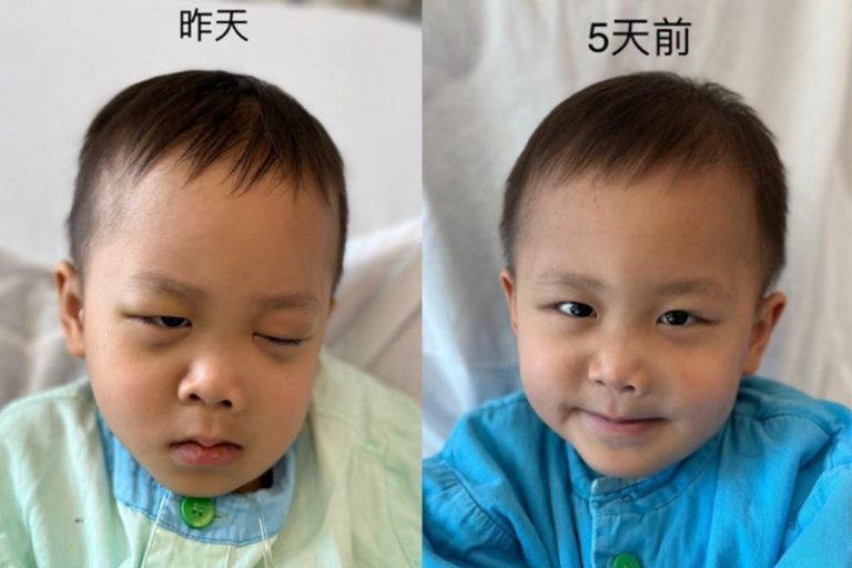 浣熊眼