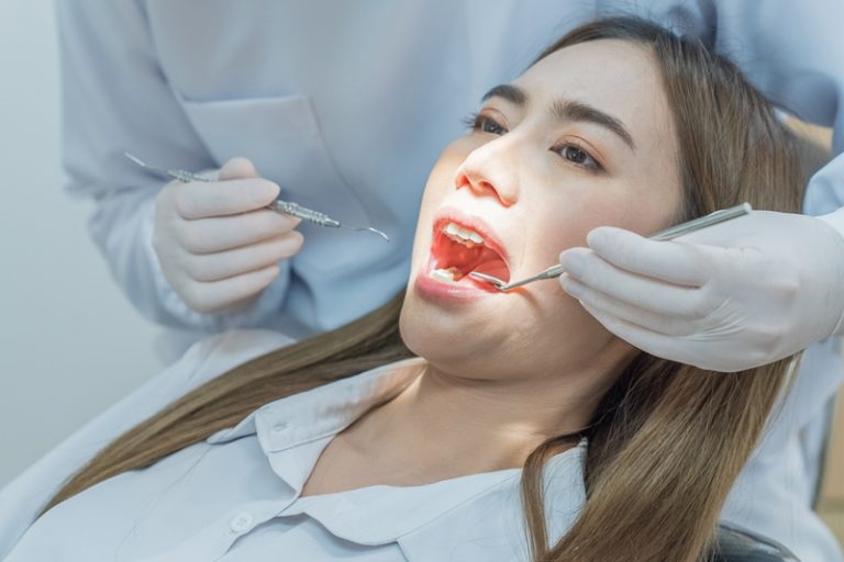 口腔頜面外科｜女士較易有牙骹痛？牙骹都可以洗？醫生拆解牙骹痛病徵、診斷及治療方法