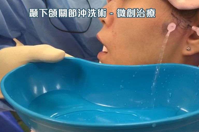顳下頜關節沖洗術 - 微創治療