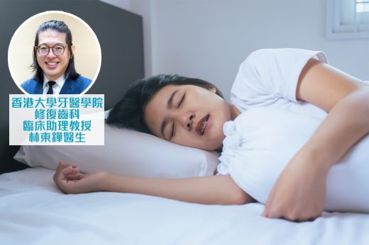 磨牙治療｜磨牙原因多 與睡眠窒息有關？牙醫拆解磨牙症狀、影響、治療方法和自我檢查貼士