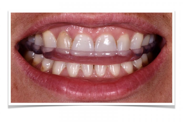 香港大學牙醫學院修復齒科臨床助理教授林東鏵醫生